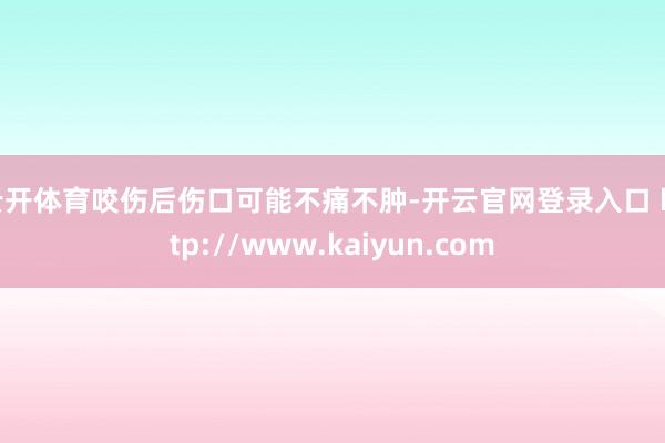 云开体育咬伤后伤口可能不痛不肿-开云官网登录入口 http://www.kaiyun.com